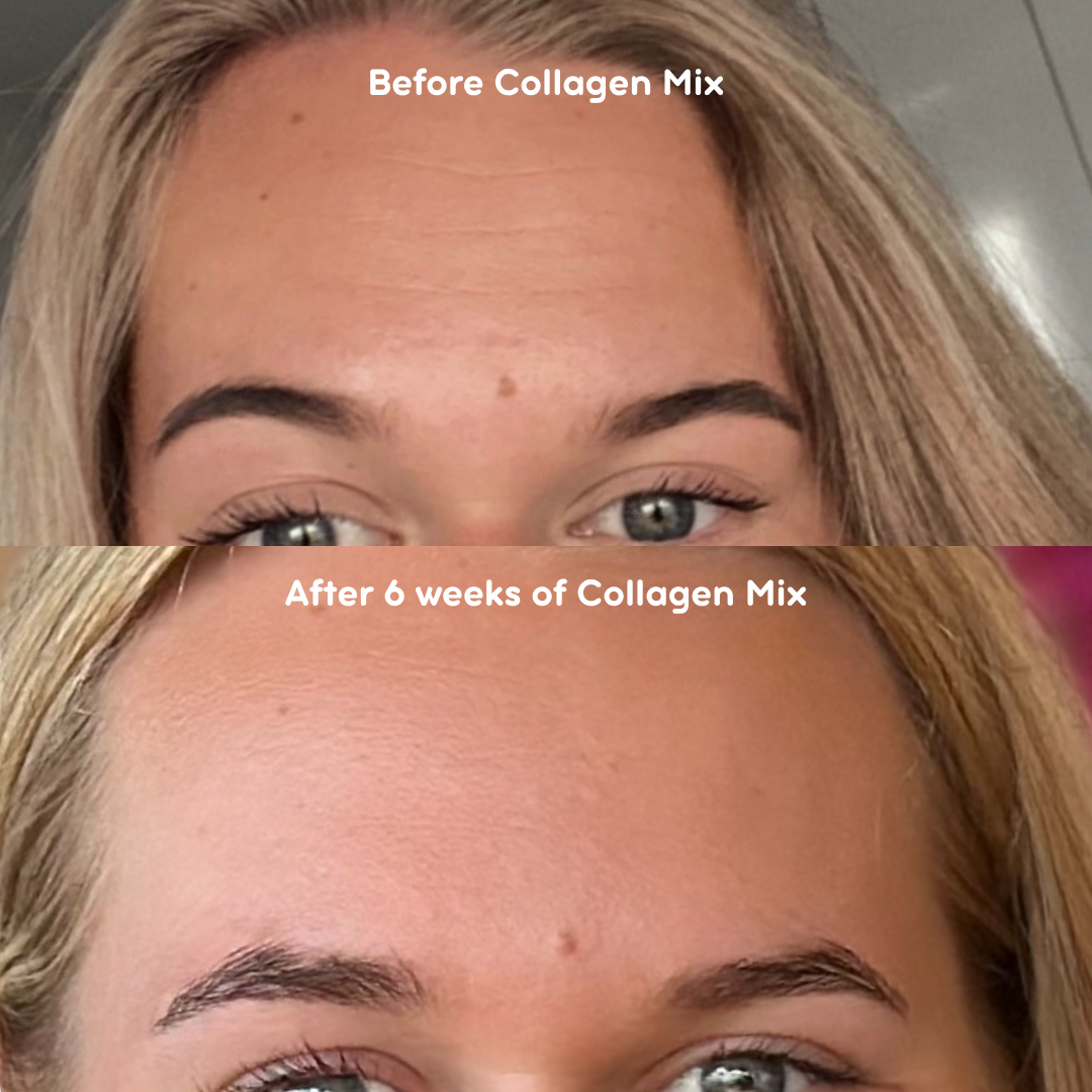 Collagen Mix