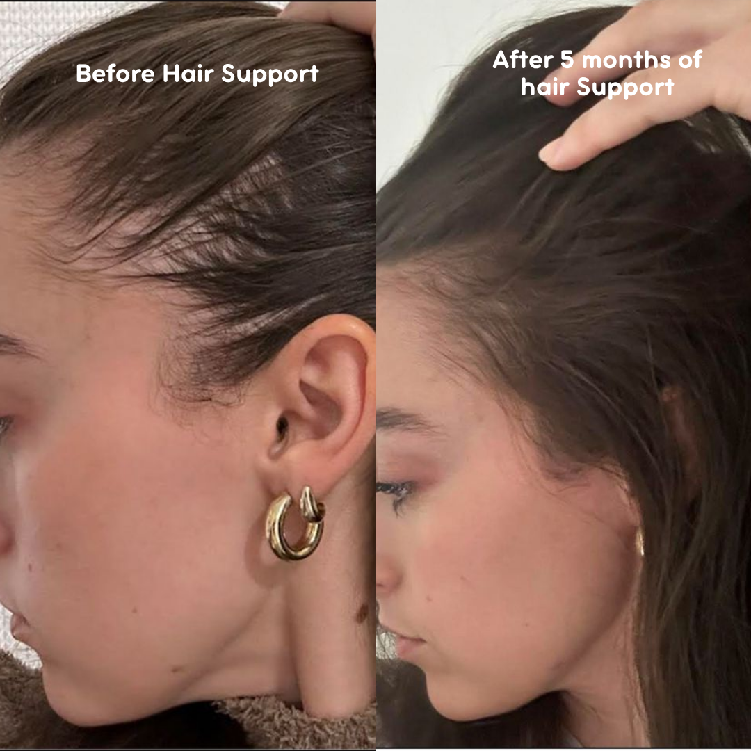 Hair Support