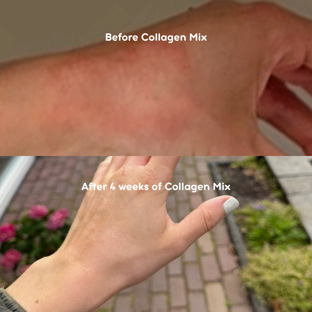 Collagen Mix