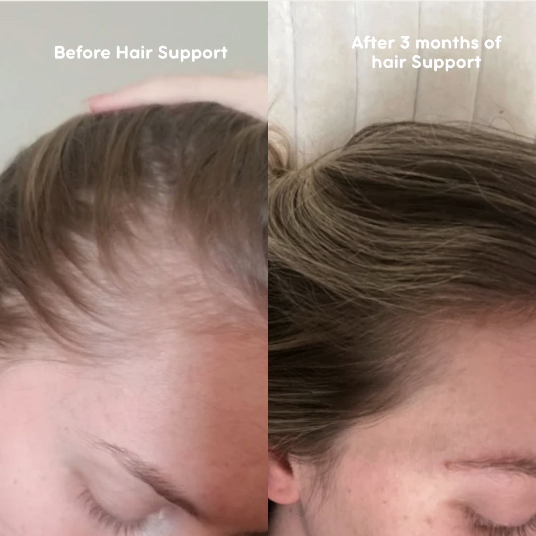 Hair Support